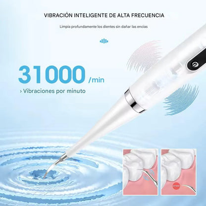 UltraDent Pro™ (2 en 1)- Remueve placa y manchas desde casa — sin pagar de más al dentista