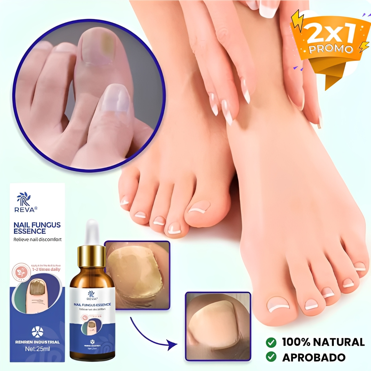 TRATAMIENTO ANTI HONGOS 7 DÍAS  100% NATURAL - OFERTA 2X1 SOLO HOY
