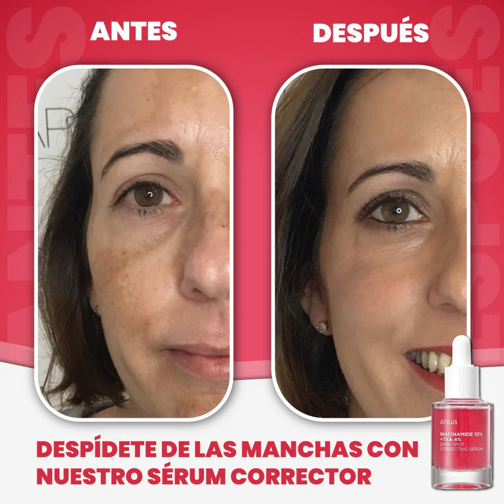 Anua - Sérum Facial Azelaic Acid 10 - GRATIS Sérum Anti Acné (oferta solo por hoy)